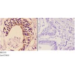 Anti-Maspin (T118) Antibody from Bioworld Technology (BS2233) - Antibodies.com