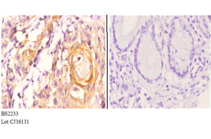 Anti-Maspin (T118) Antibody from Bioworld Technology (BS2233) - Antibodies.com
