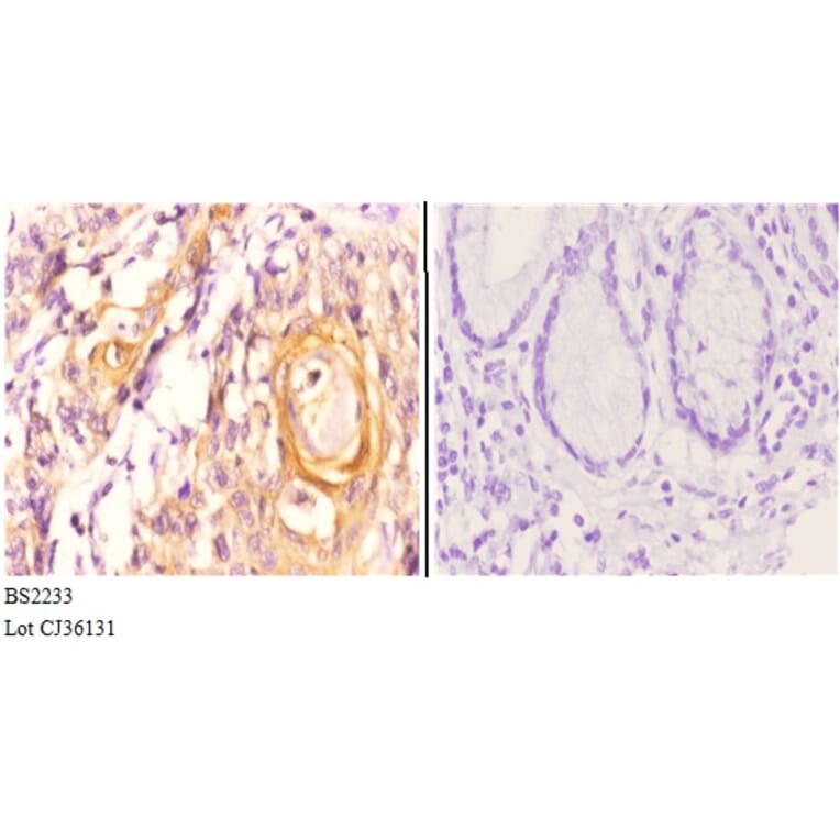 Anti-Maspin (T118) Antibody from Bioworld Technology (BS2233) - Antibodies.com