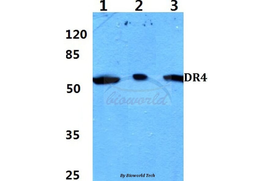 Anti-DR4 (D430) Antibody from Bioworld Technology (BS2238) - Antibodies.com