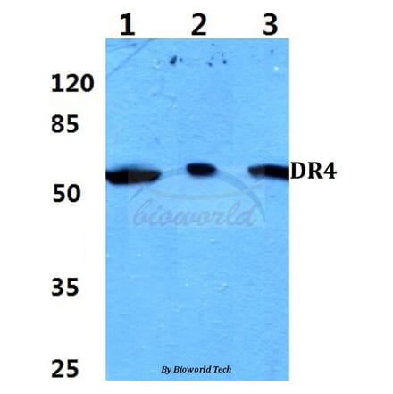 Anti-DR4 (D430) Antibody from Bioworld Technology (BS2238) - Antibodies.com