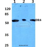 Anti-DR4 (D430) Antibody from Bioworld Technology (BS2238) - Antibodies.com