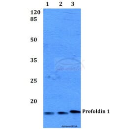 Anti-Prefoldin 1 (E35) Antibody from Bioworld Technology (BS2245) - Antibodies.com