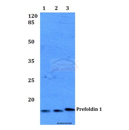 Anti-Prefoldin 1 (E35) Antibody from Bioworld Technology (BS2245) - Antibodies.com