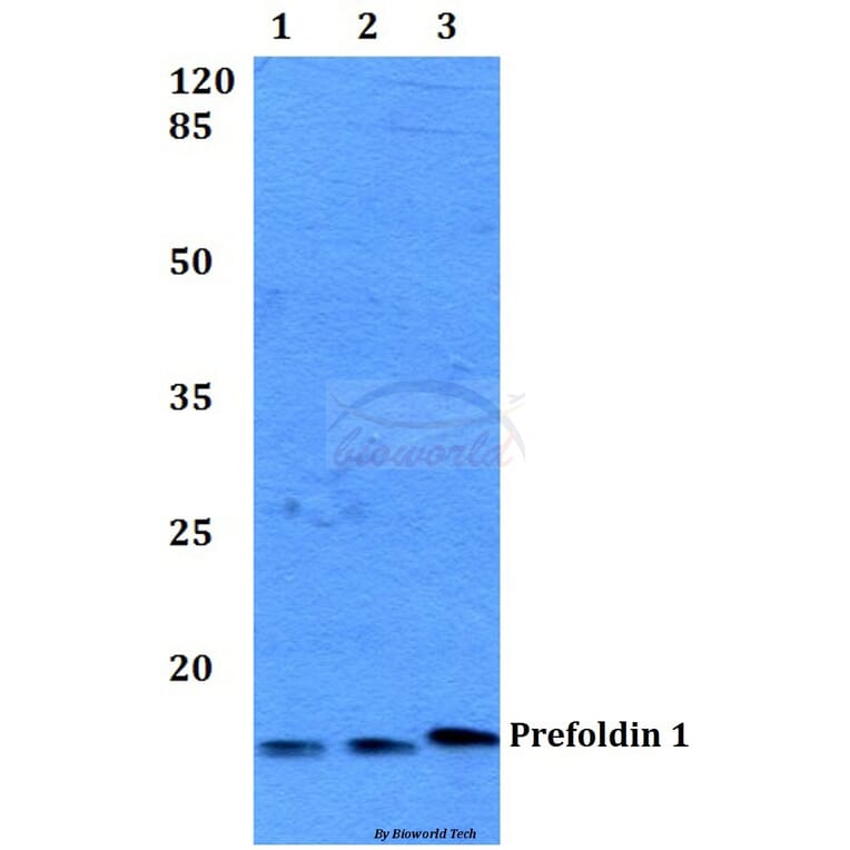 Anti-Prefoldin 1 (E35) Antibody from Bioworld Technology (BS2245) - Antibodies.com