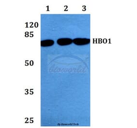 Anti-HBO1 (S167) Antibody from Bioworld Technology (BS2248) - Antibodies.com