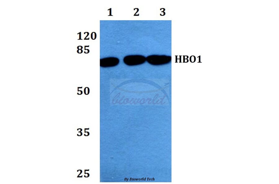 Anti-HBO1 (S167) Antibody from Bioworld Technology (BS2248) - Antibodies.com
