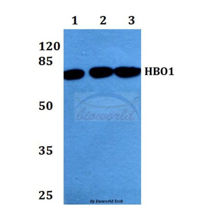 Anti-HBO1 (S167) Antibody from Bioworld Technology (BS2248) - Antibodies.com