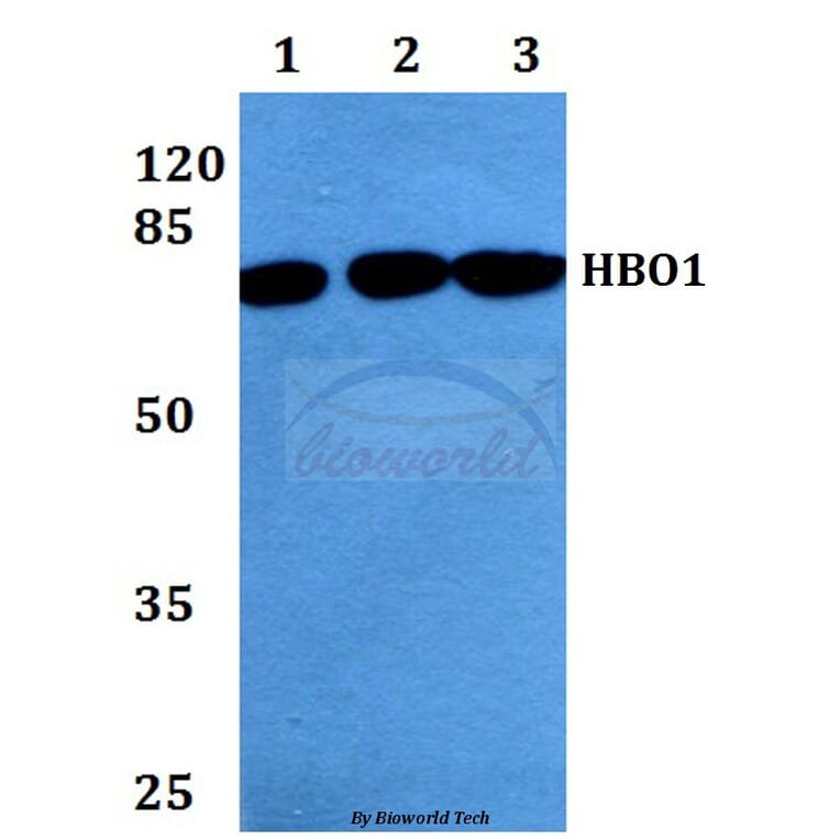 Anti-HBO1 (S167) Antibody from Bioworld Technology (BS2248) - Antibodies.com