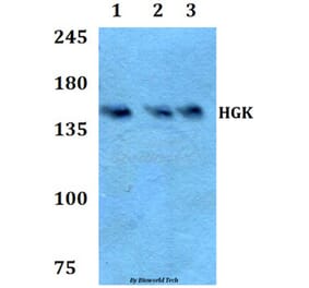 Anti-HGK (R430) Antibody from Bioworld Technology (BS2249) - Antibodies.com