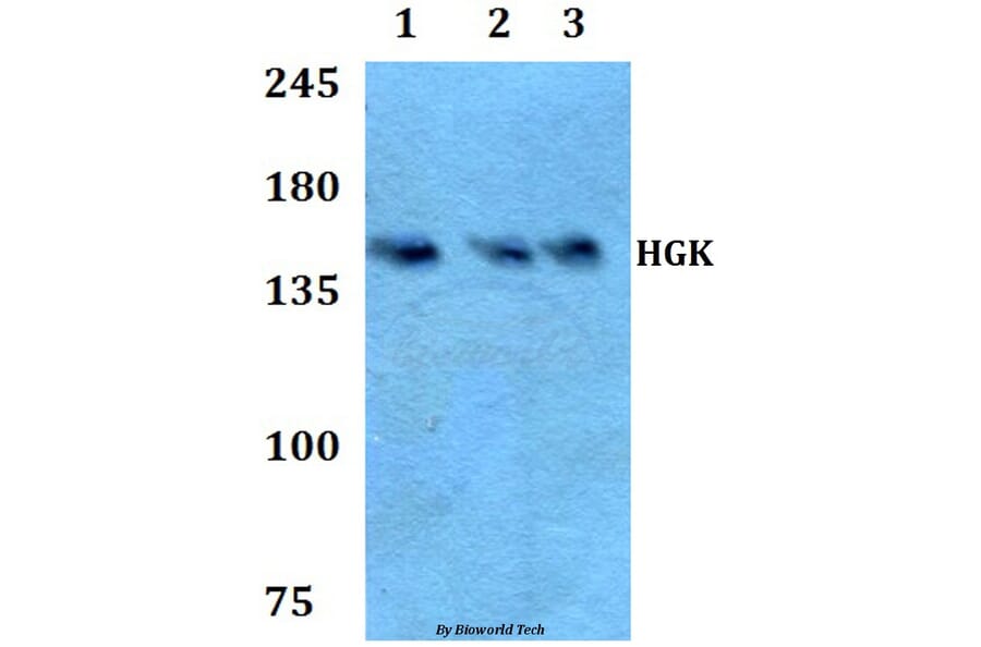 Anti-HGK (R430) Antibody from Bioworld Technology (BS2249) - Antibodies.com