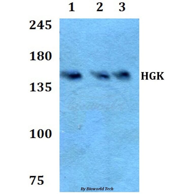 Anti-HGK (R430) Antibody from Bioworld Technology (BS2249) - Antibodies.com