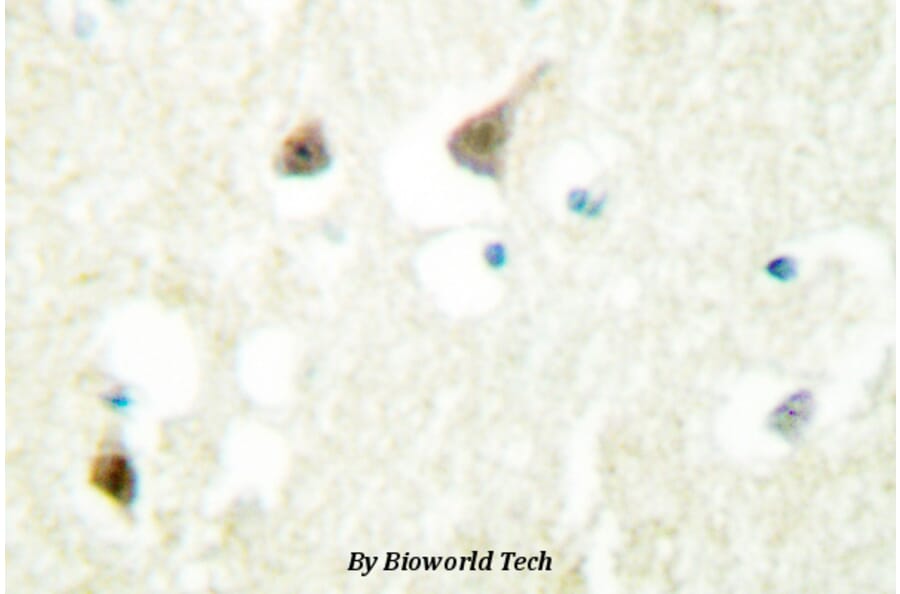 Anti-hnRNP C1/2 (D271) Antibody from Bioworld Technology (BS2252) - Antibodies.com