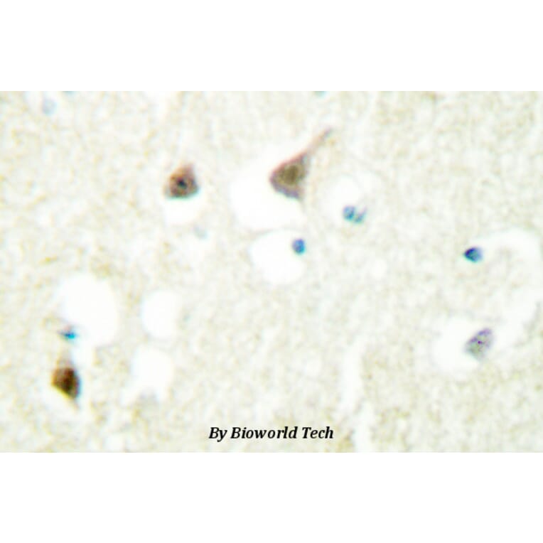 Anti-hnRNP C1/2 (D271) Antibody from Bioworld Technology (BS2252) - Antibodies.com