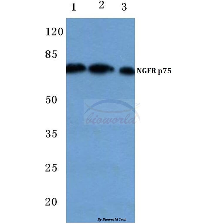Anti-NGFR p75 (P150) Antibody from Bioworld Technology (BS2253) - Antibodies.com