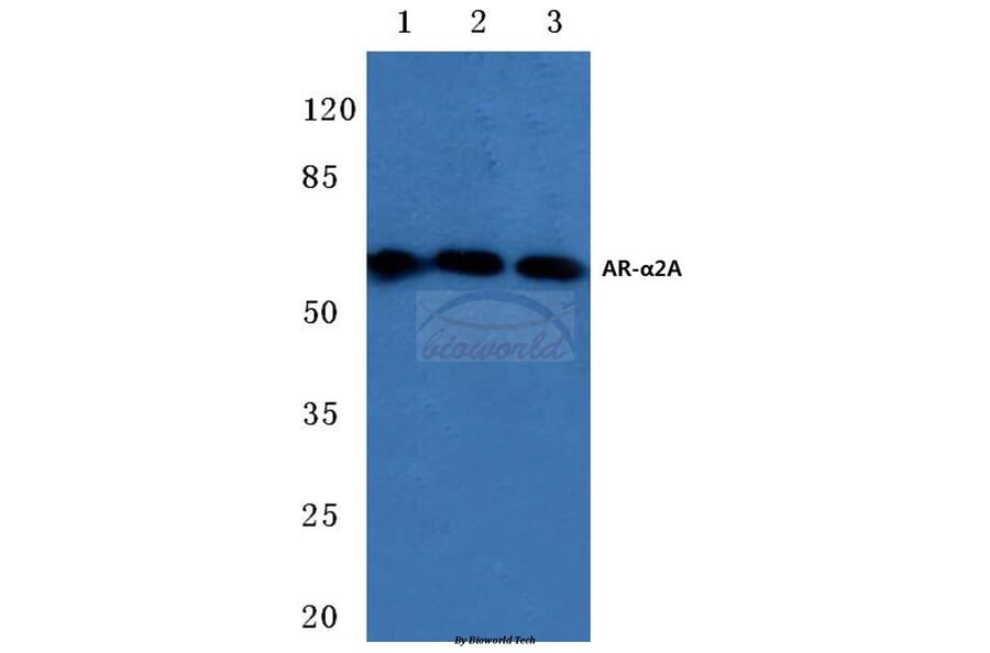 Anti-AR-α2A (R361) Antibody from Bioworld Technology (BS2254) - Antibodies.com