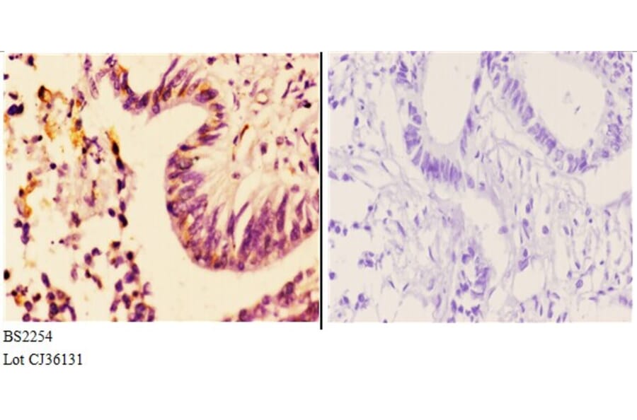 Anti-AR-α2A (R361) Antibody from Bioworld Technology (BS2254) - Antibodies.com