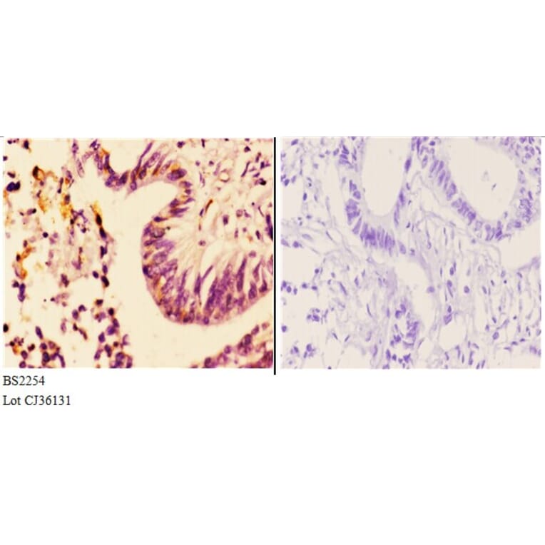 Anti-AR-α2A (R361) Antibody from Bioworld Technology (BS2254) - Antibodies.com