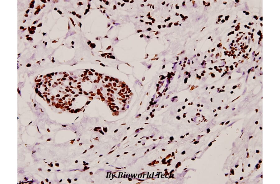 Anti-hnRNP A1 (E85) Antibody from Bioworld Technology (BS2255) - Antibodies.com