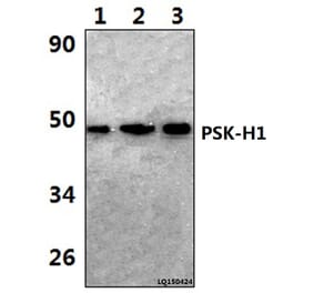 Anti-PSK-H1 (M295) Antibody from Bioworld Technology (BS2256) - Antibodies.com