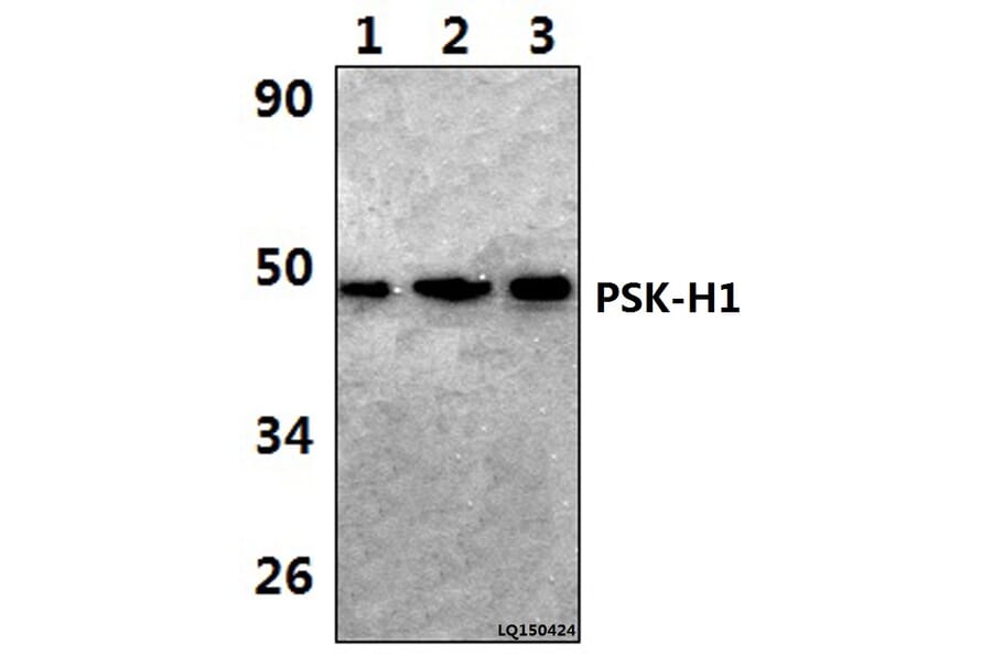 Anti-PSK-H1 (M295) Antibody from Bioworld Technology (BS2256) - Antibodies.com