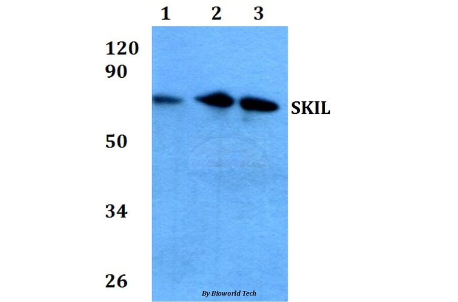 Anti-SKIL (D652) Antibody from Bioworld Technology (BS2257) - Antibodies.com