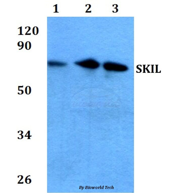 Anti-SKIL (D652) Antibody from Bioworld Technology (BS2257) - Antibodies.com