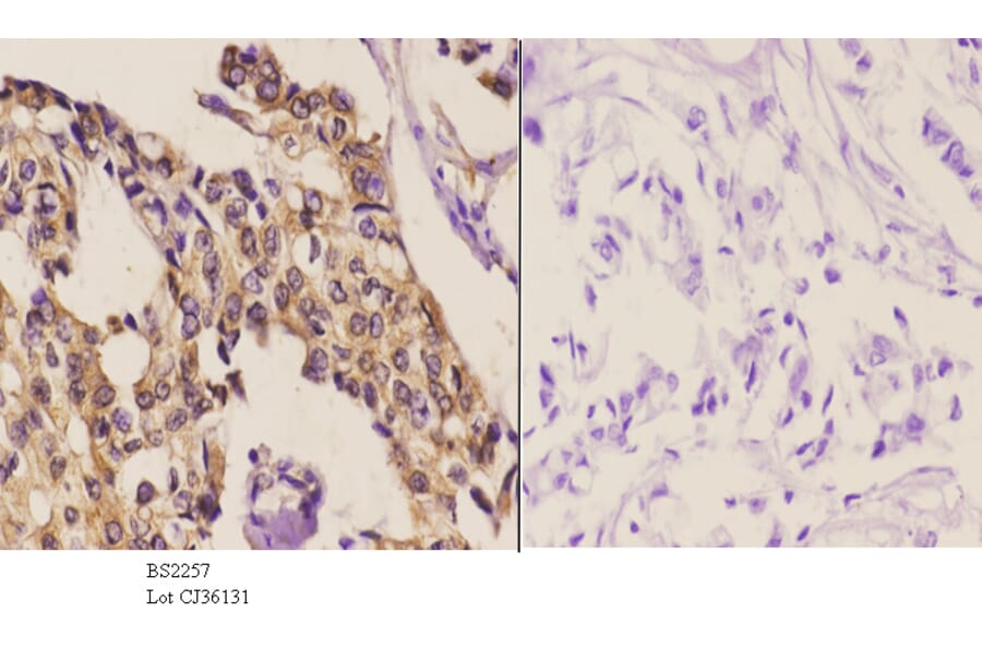 Anti-SKIL (D652) Antibody from Bioworld Technology (BS2257) - Antibodies.com