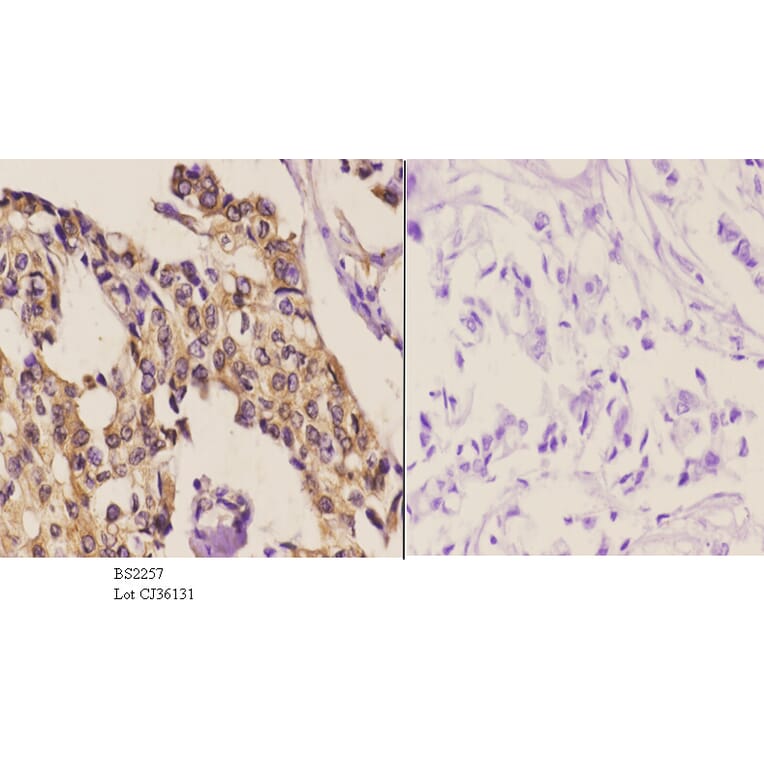 Anti-SKIL (D652) Antibody from Bioworld Technology (BS2257) - Antibodies.com