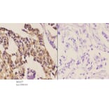 Anti-SKIL (D652) Antibody from Bioworld Technology (BS2257) - Antibodies.com