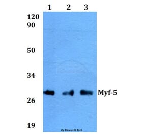 Anti-Myf-5 (A88) Antibody from Bioworld Technology (BS2258) - Antibodies.com