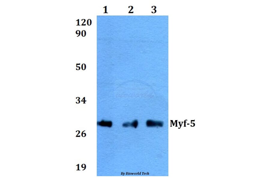 Anti-Myf-5 (A88) Antibody from Bioworld Technology (BS2258) - Antibodies.com