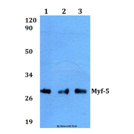 Anti-Myf-5 (A88) Antibody from Bioworld Technology (BS2258) - Antibodies.com