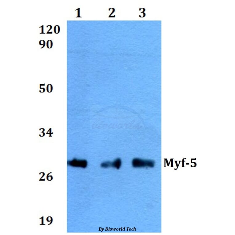 Anti-Myf-5 (A88) Antibody from Bioworld Technology (BS2258) - Antibodies.com