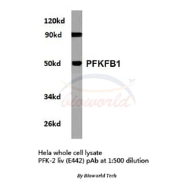 Anti-PFKFB1 (E442) Antibody from Bioworld Technology (BS2259) - Antibodies.com