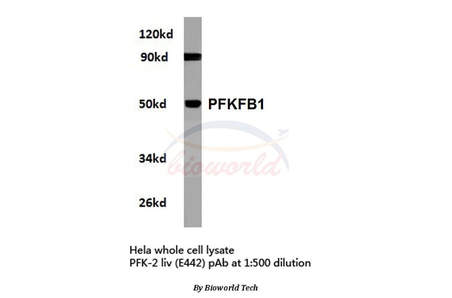 Anti-PFKFB1 (E442) Antibody from Bioworld Technology (BS2259) - Antibodies.com