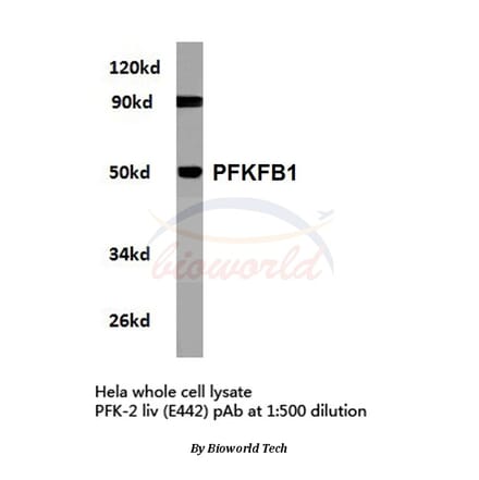 Anti-PFKFB1 (E442) Antibody from Bioworld Technology (BS2259) - Antibodies.com