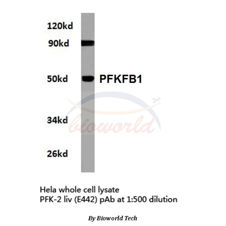 Anti-PFKFB1 (E442) Antibody from Bioworld Technology (BS2259) - Antibodies.com