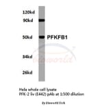 Anti-PFKFB1 (E442) Antibody from Bioworld Technology (BS2259) - Antibodies.com