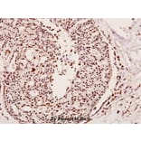 Anti-PFKFB1 (E442) Antibody from Bioworld Technology (BS2259) - Antibodies.com