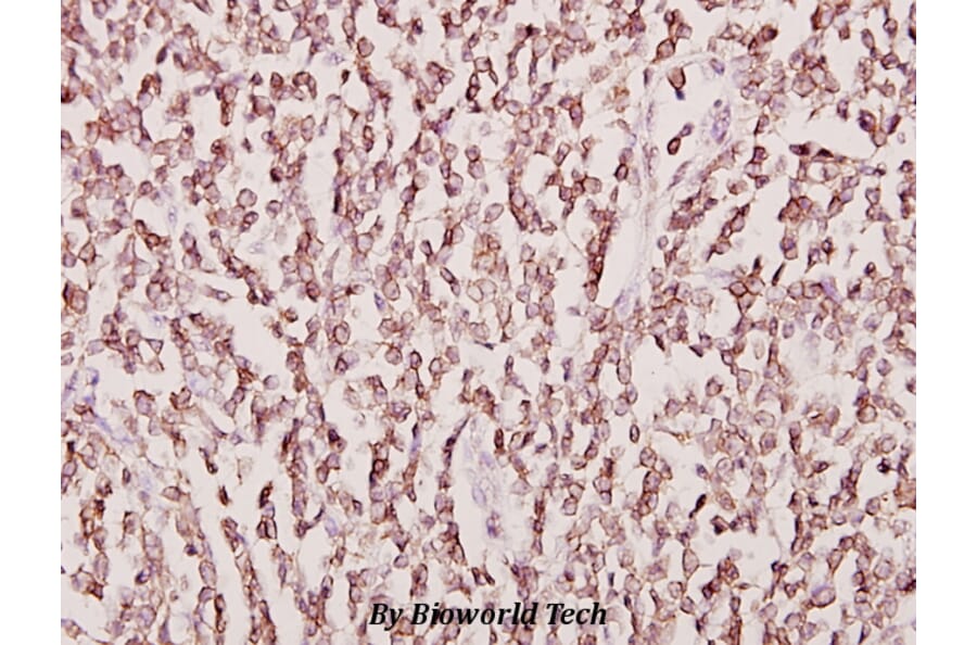 Anti-CKMT2 (W262) Antibody from Bioworld Technology (BS2260) - Antibodies.com