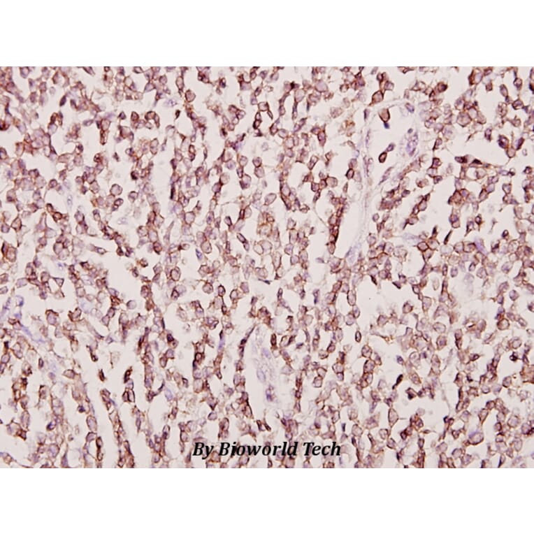 Anti-CKMT2 (W262) Antibody from Bioworld Technology (BS2260) - Antibodies.com