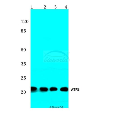 Anti-ATF3 (N159) Antibody from Bioworld Technology (BS2261) - Antibodies.com