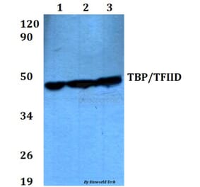 Anti-TBP (A184) Antibody from Bioworld Technology (BS2262) - Antibodies.com