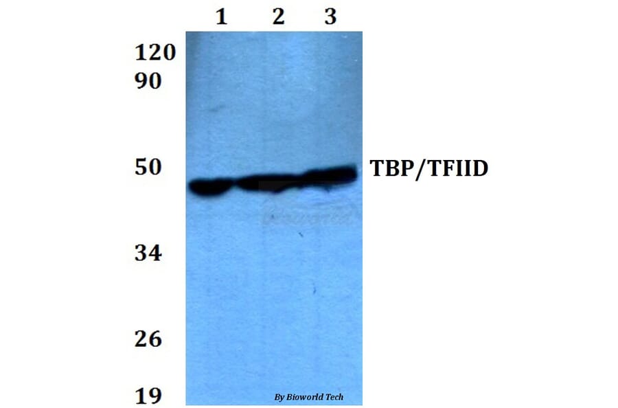 Anti-TBP (A184) Antibody from Bioworld Technology (BS2262) - Antibodies.com