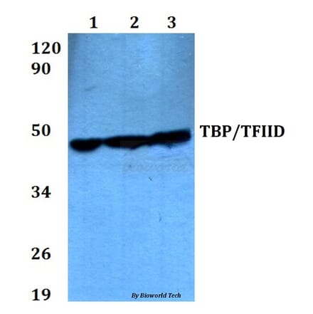 Anti-TBP (A184) Antibody from Bioworld Technology (BS2262) - Antibodies.com