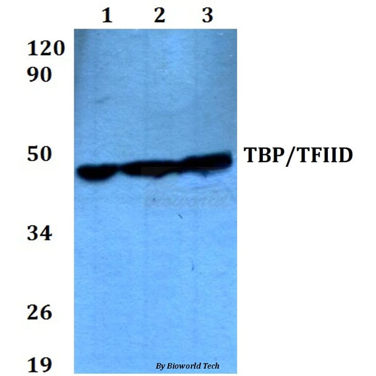 Anti-TBP (A184) Antibody from Bioworld Technology (BS2262) - Antibodies.com