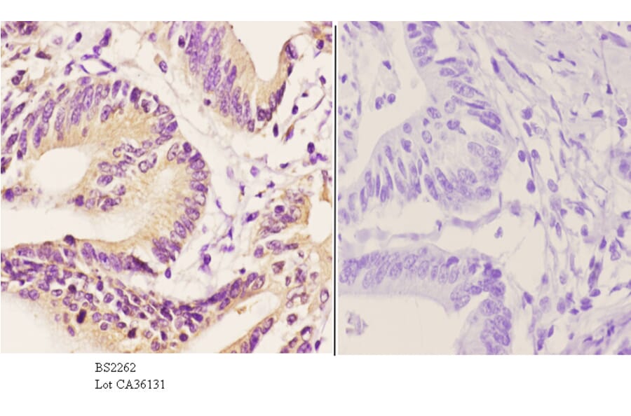 Anti-TBP (A184) Antibody from Bioworld Technology (BS2262) - Antibodies.com