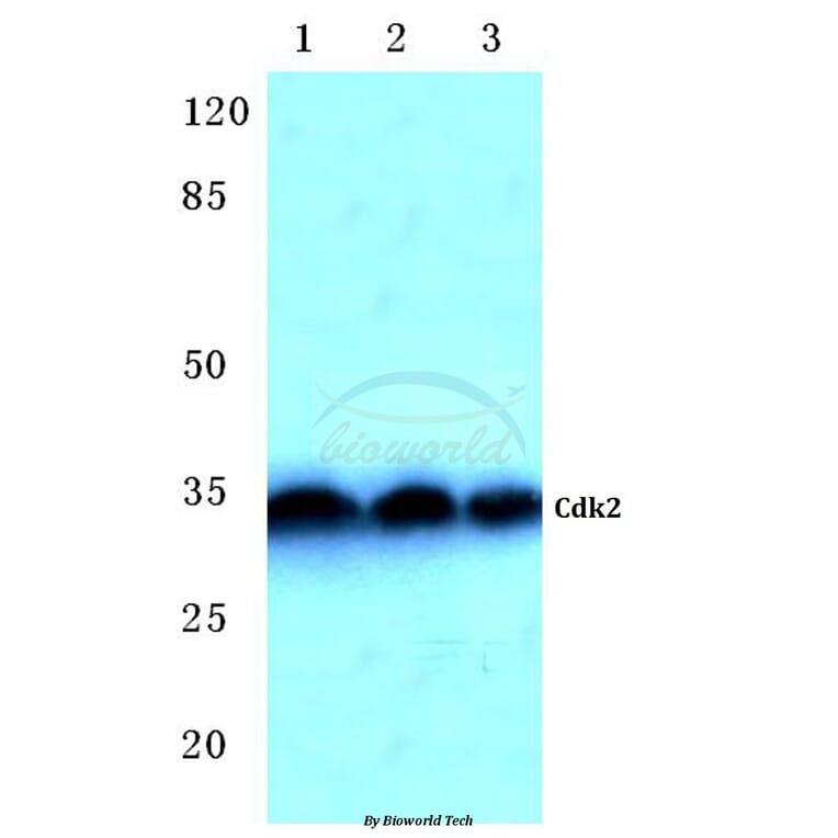 Anti-Cdk2 (Q265) Antibody from Bioworld Technology (BS2263) - Antibodies.com