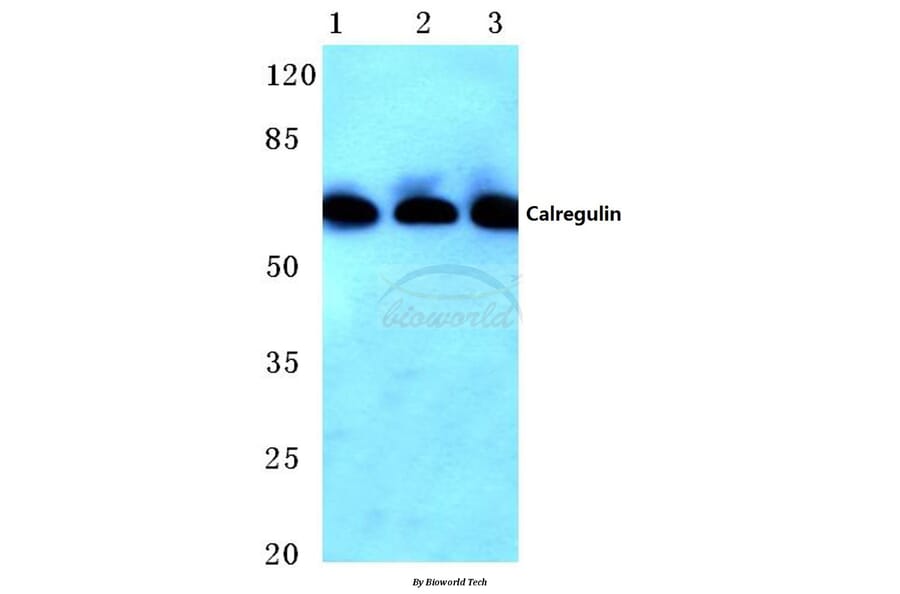 Anti-Calregulin (G54) Antibody from Bioworld Technology (BS2264) - Antibodies.com